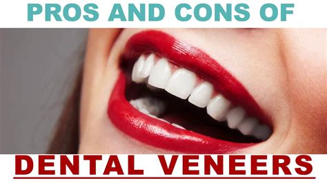pros and cons of dental veneers youtube mayo s interests