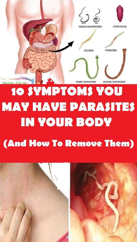 10 Symptoms You Have Parasites In Your Body And How To Remove Them