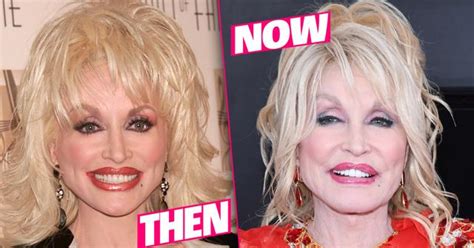 dolly parton s plastic face fiasco revealed in shocking new photos