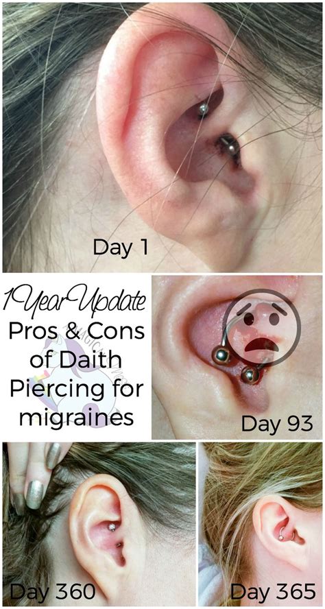 migraine piercing ideas  pinterest daith