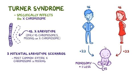 Turner Syndrome Video Anatomy Definition And Function Osmosis