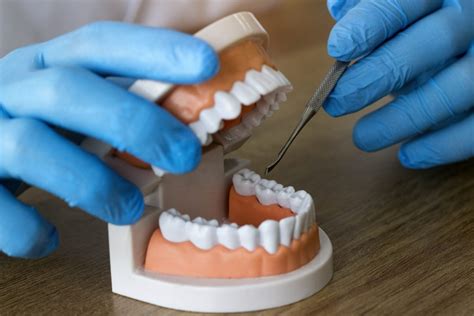 la importancia del protesico dental canodent