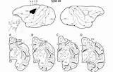 Lateral Cerebral Hemispheres sketch template