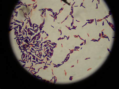 lactobacillus microbiology pinterest