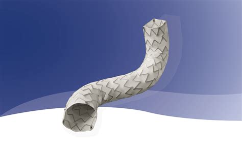 ivascular receives ce mark  icover covered stent renal interventions