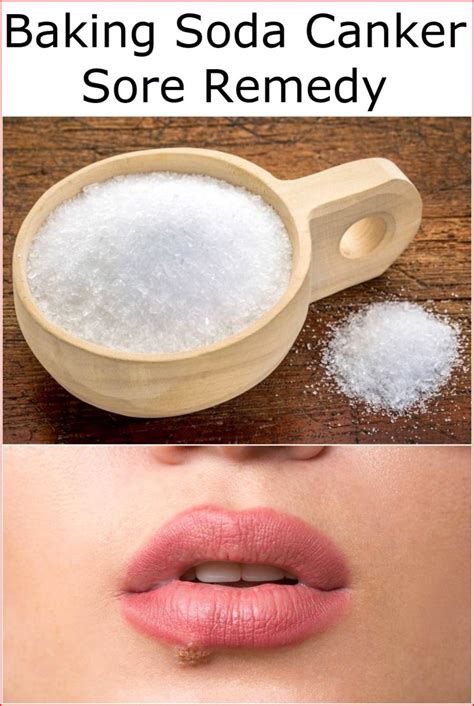 baking soda canker sore remedy baking soda uses and diy home remedies