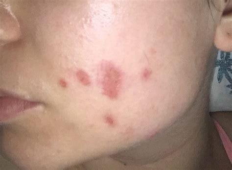 i have a rash on my face is it a skin infection ask a