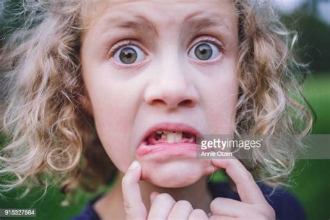 Girl With Bad Teeth 個照片及圖片檔 Getty Images
