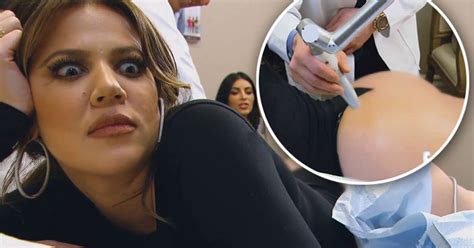 watch khloe kardashian get her bum lasered for stretch marks and cellulite after revealing