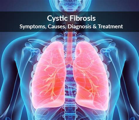 Cystic Fibrosis Symptoms Causes Diagnosis And Treatment