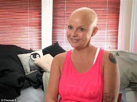 Gail Porter Reveals Results Of Her Dramatic Breast Reduction Daily