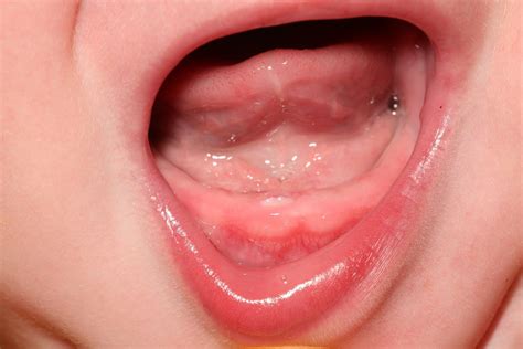 teething symptoms pay attention   small signs  baby shows