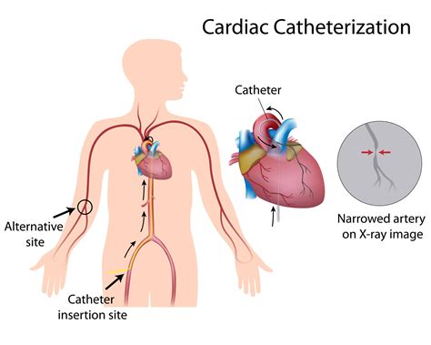 patient services cvg cares cvg cares