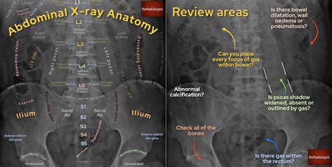 abdominal  ray anatomy  interpretation checklist grepmed