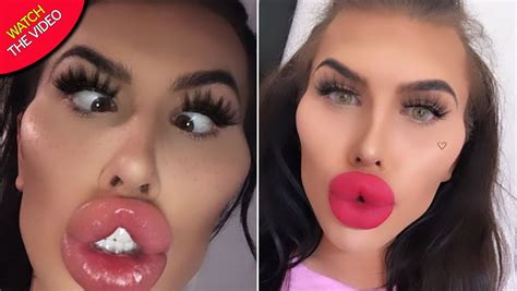 Woman With Uk S Biggest Lips Makes £5 000 Each Month By Financially