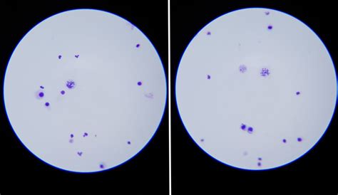 Human Chromosome Under The Microscope 🔬 — Steemit