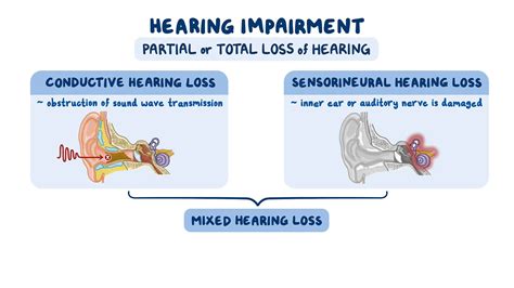 Sensorineural Hearing Loss Vs Conductive Hearing Loss