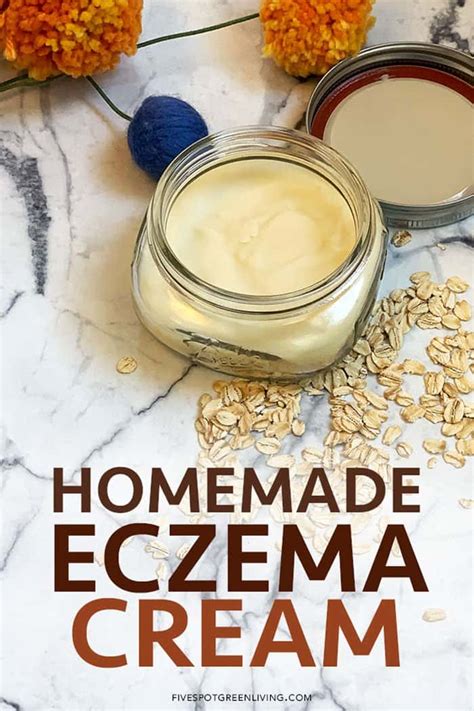 homemade eczema cream recipe  dry winter skin  spot green living