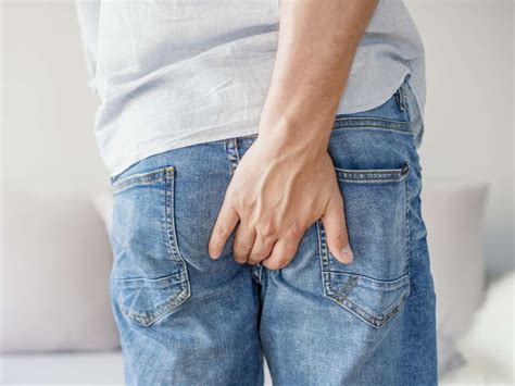 thrombosed hemorrhoids symptoms causes and outlook