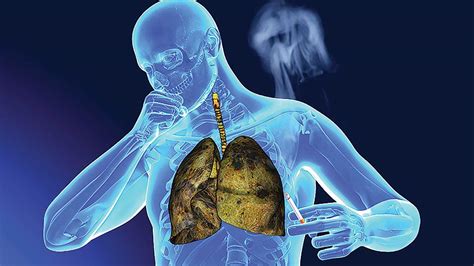 Try Healthy Diet To Reduce Lung Cancer Risks The