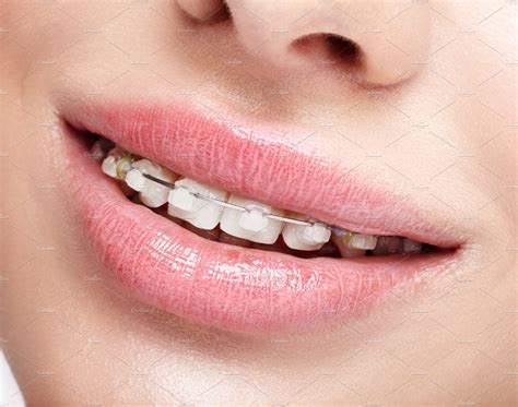 closeup  woman open smiling mouth high quality stock