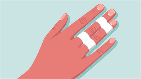 how to rehab a broken finger youtube