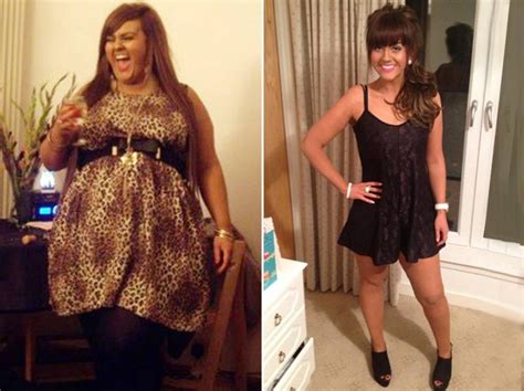 uk woman loses 9 stone after weight loss surgery gastric