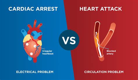 differences  heart attack  cardiac arrest rapid response revival