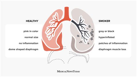 smokers lungs  healthy lungs facts pictures