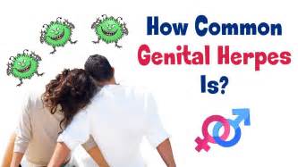 how common genital herpes is causes signs and symptoms