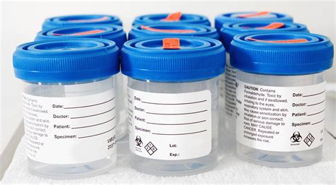 defining durability  industrial labels    label matters biolab business magazine
