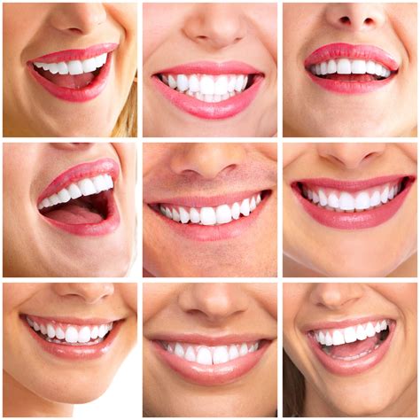 smile design  coplay   dental blog dentist lehigh
