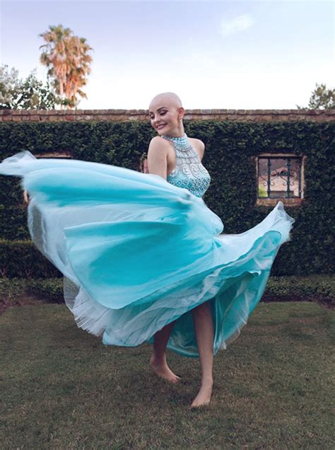 bald teen goes viral uses glamorous photoshoot to spread riveting
