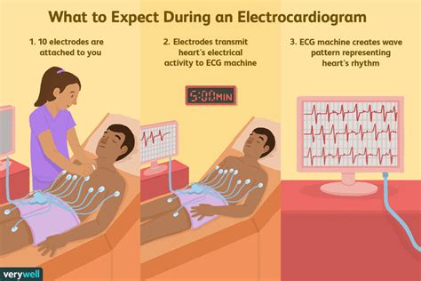 electrocardiogram ecg  ekg procedure  results