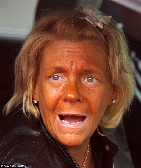 tan mom patricia krentcil has discovered botox and says her pale look has helped her sex life