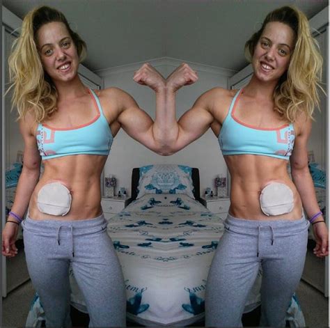Female Bodybuilder Breaks Stigma Over Ulcerative Colitis With
