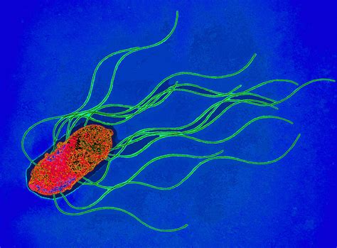 food poisoning  holiday holiday illness compensation