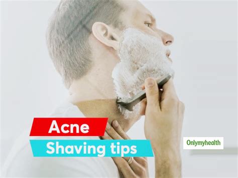 do you have acne here are some shaving tips for men to