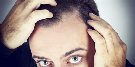 Going Bald From The Sun And Other Hair Loss Myths Huffpost Uk