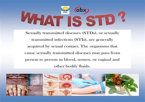 Pin On Sexually Transmitted Disease Std