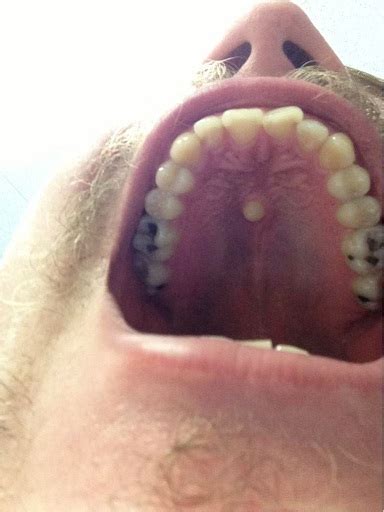 is this the weirdest tooth you ve ever seen man unaware