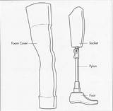 Limb Prosthesis Typical Above Manufacture sketch template