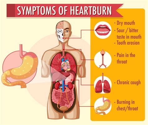 symptoms  heartburn infographic  vector art  vecteezy