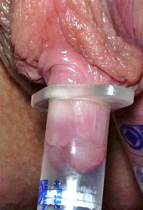 vacuum stimulating of clitoris torture photos