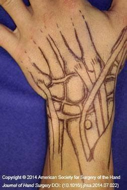 wrist anatomy advanced rehab seminars