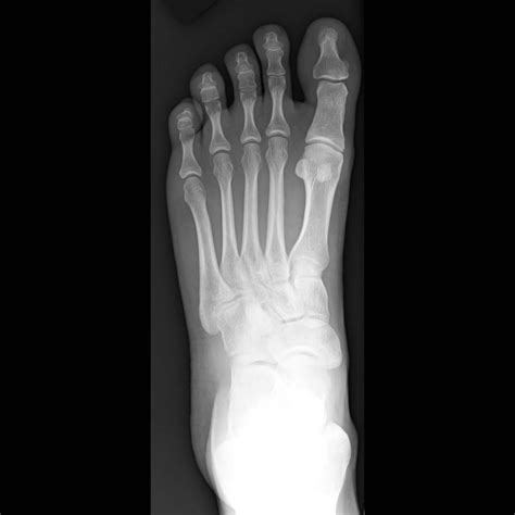 foot xray anatomy