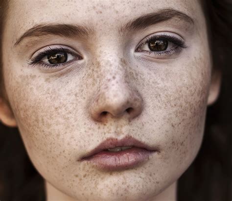 freckled pale