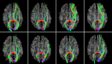 gps   brain uga researchers develop  brain map uga today