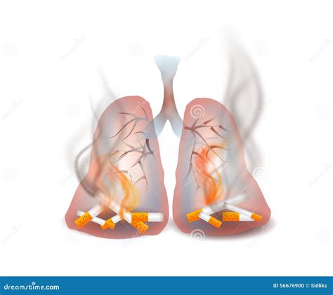 ongezonde rooklongen stock illustratie illustration  malaise
