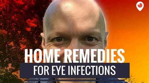 home remedies   eye infection youtube